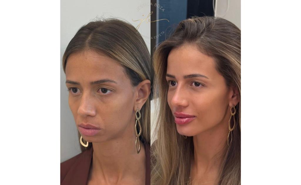 Beleza não é volume
